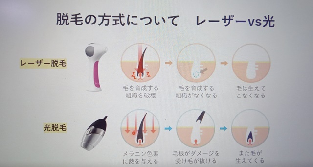 レーザーと光式の違い